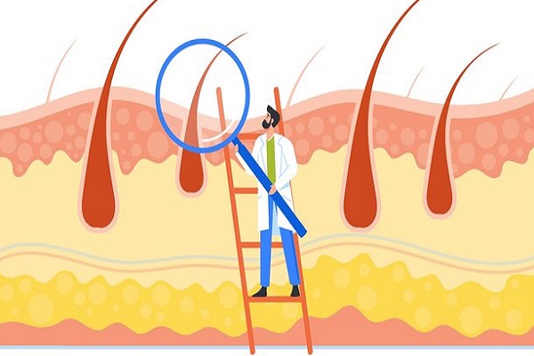 Five Most Common Scalp Conditions You Need To Know