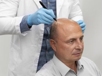 Top 3 best hair transplant clinics and doctors in Dallas