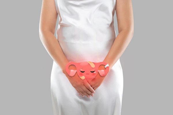 polycystic ovary syndrome hair loss