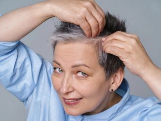 alopecia in menopause