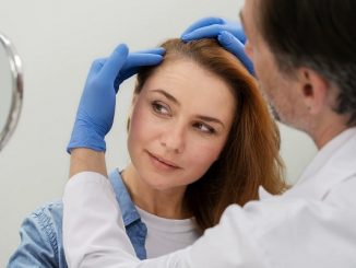 hair transplant for women