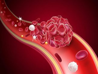 alopecia and blood circulation