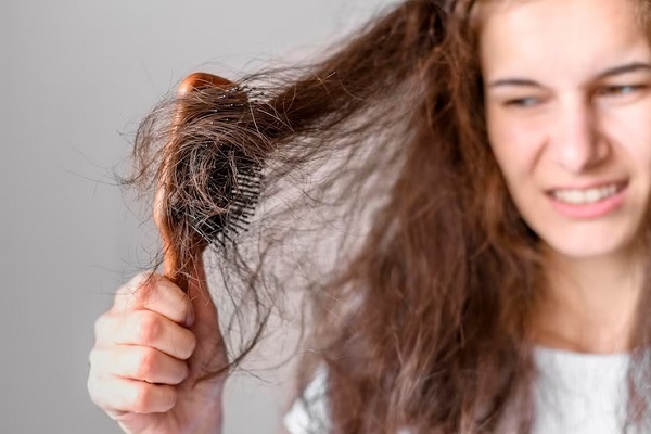 Will Your Oily Scalp Make You Go Bald